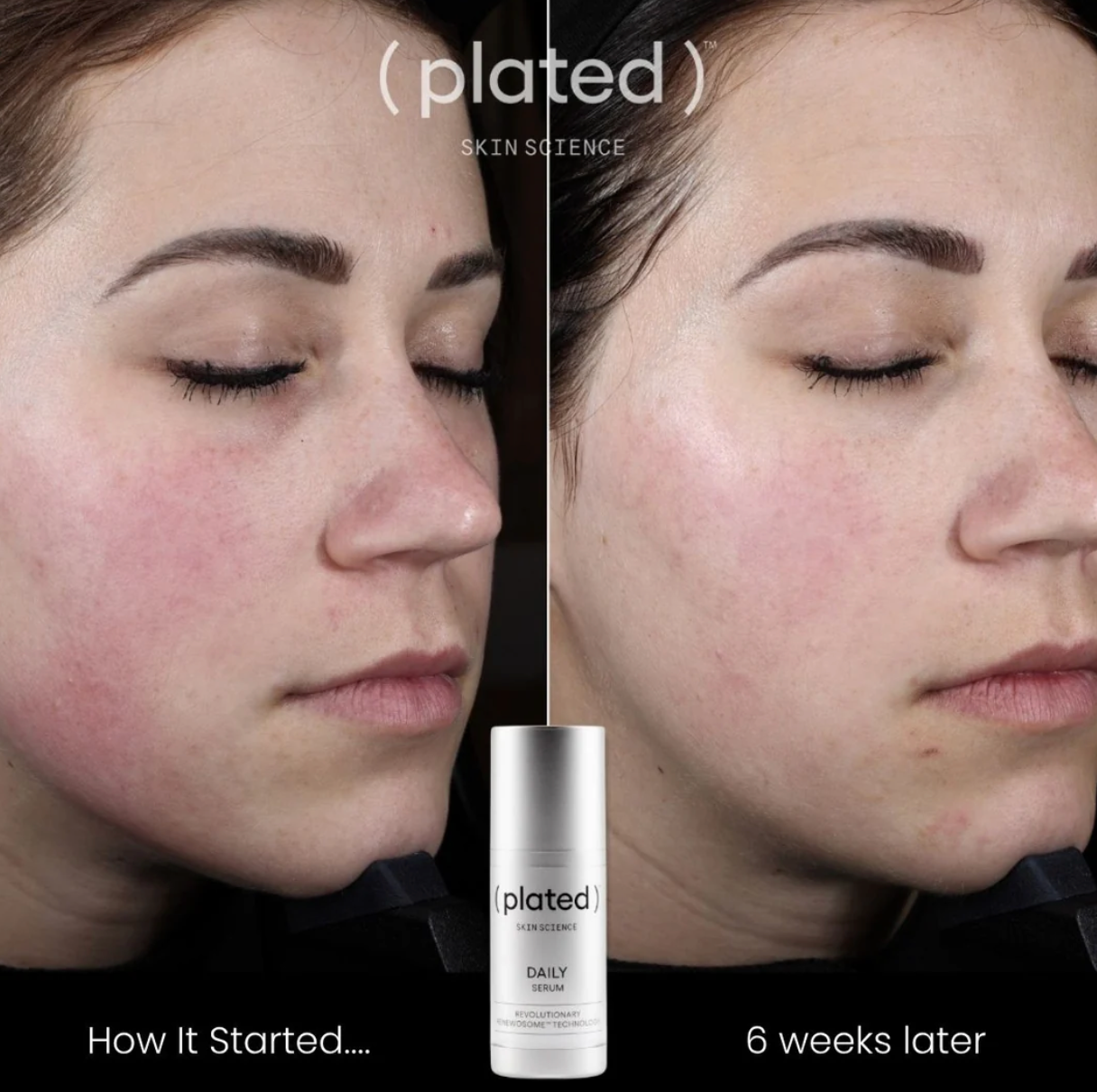 Plated Daily Serum